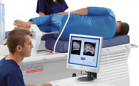 High-Intensity Focused Ultrasound (HIFU) Therapy Service