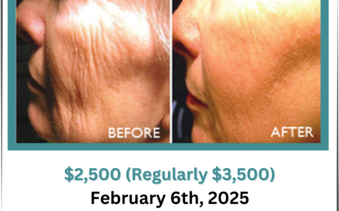 CO2 Fractional Skin Resurfacing Post